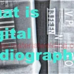 What-is-Digital-Radiography